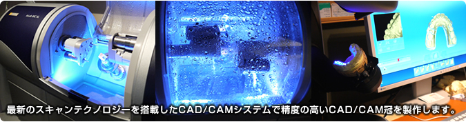 最新のスキャンテクノロジーを搭載したCAD/CAMシステムで精度の高いCAD/CAM冠を製作します。