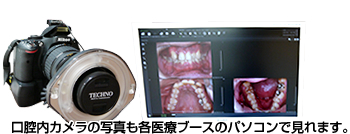 口腔内カメラの写真も各医療ブースのパソコンで見れます。